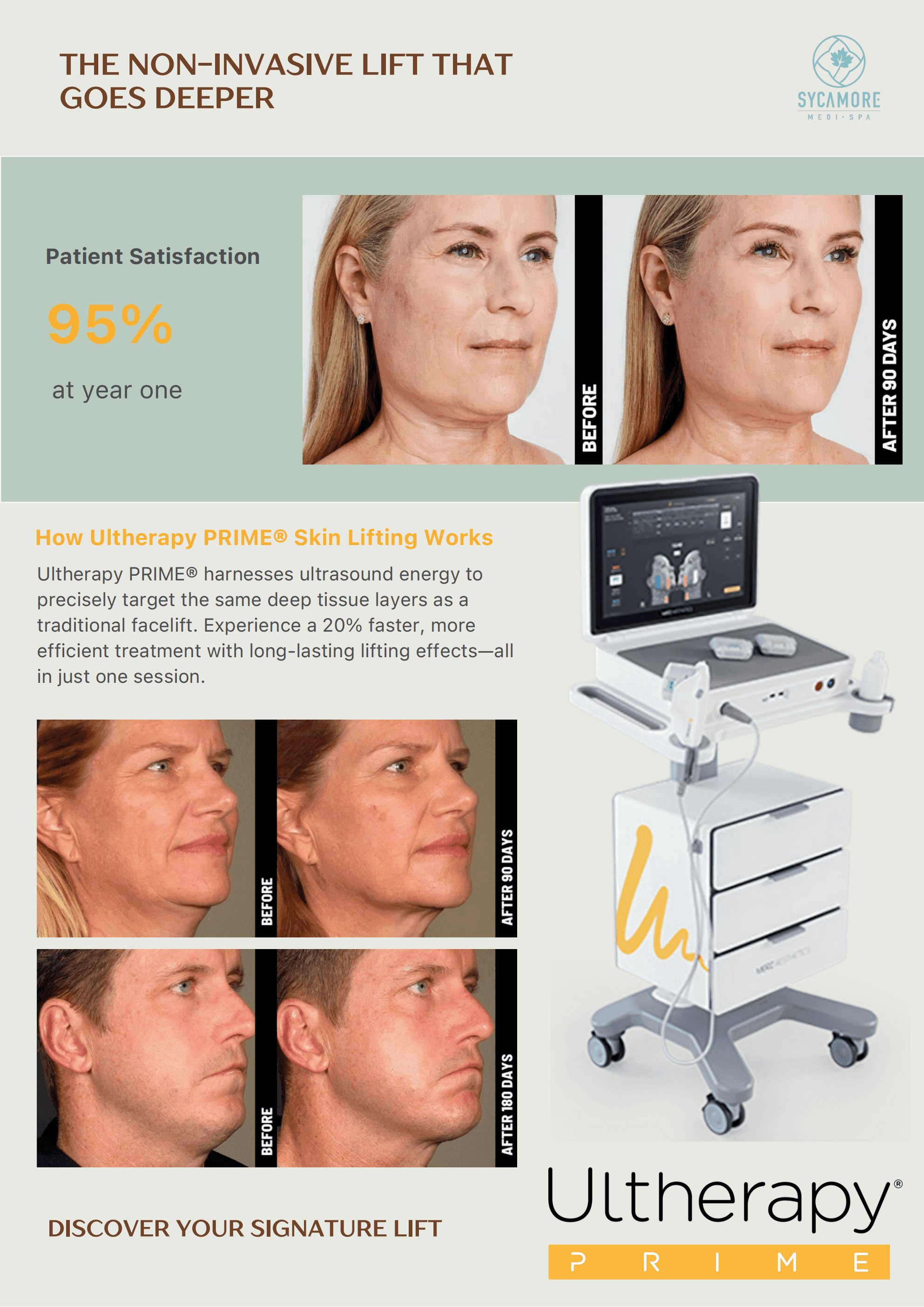 Ultherapy_Prime_1.png