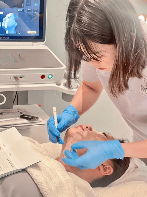 ultherapy 4.png